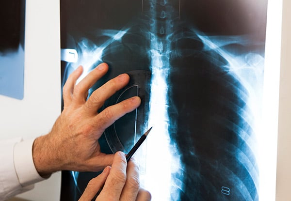 $129 for Chiropractic Consultation, X-Rays (if Required), Exam & Written Report (value up to $270)