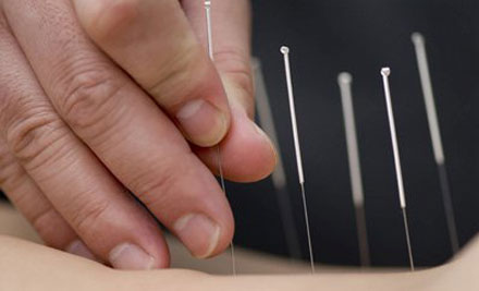 Acupuncture Specialist