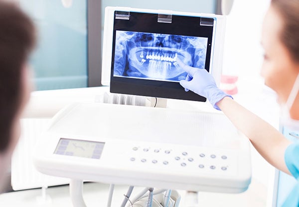 $55 for a Dental Exam & X-Ray (value $109)