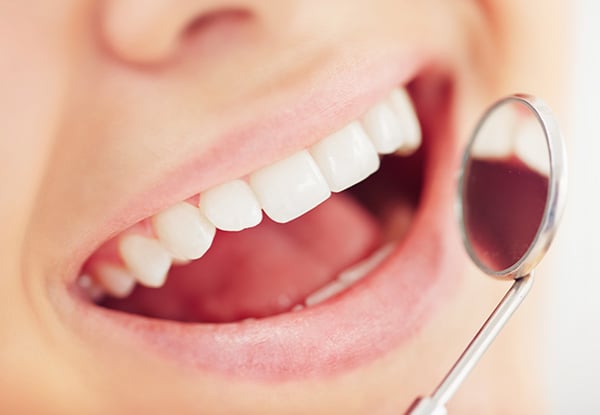 Full Dental Exam, Check Up & Clean incl. $50 Return Voucher