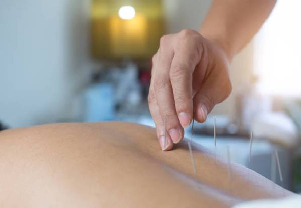 Mosgiel Acupuncture