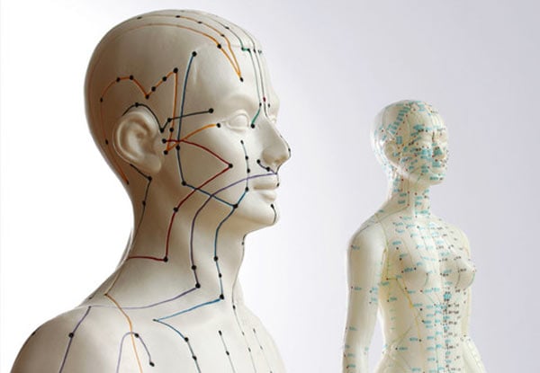 From $39 for an Acupuncture Treatment (value up to $70)