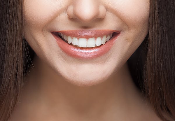 $199 for an In Surgery Teeth Whitening Service or $399 to incl. Take-Home Whitening Trays (value up to $974)