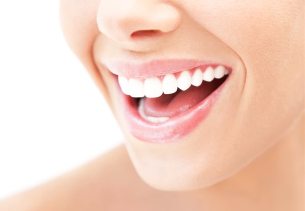 $59 for a Dental Exam, X-rays & a $50 Return Visit Voucher or $99 for a Dental Exam incl. Two X-Rays & a 45-Minute Hygienist Appointment (value up to $210)