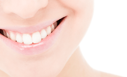 Whiter Smiles