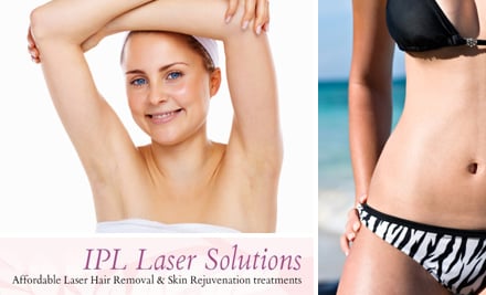 IPL Laser Solutions Levin