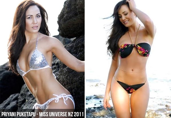$149 for Three Elite MPX Medical Grade Laser Hair Removal Treatments for Three Areas (value up to $885)