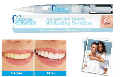 Diamond Whitening
