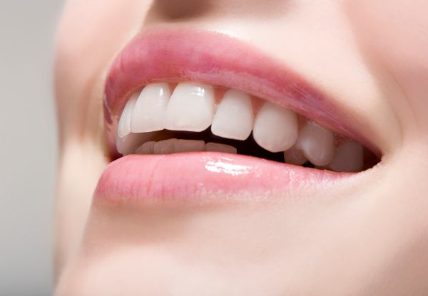Nelson Teeth Whitening