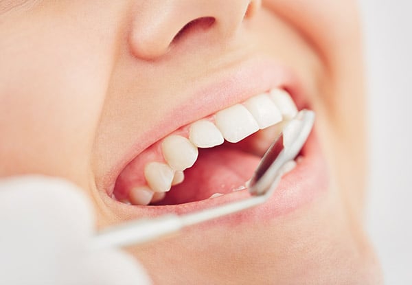 NZ Dental Health Warranties