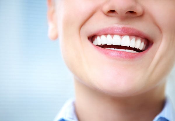 $99 for a One-Hour Cosmetic LED Laser Teeth Whitening (value up to $344)