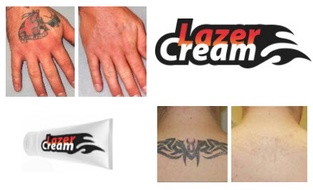 tattooremovalcream.com.au