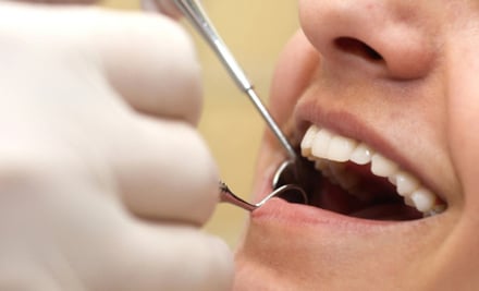 Apex Dental
