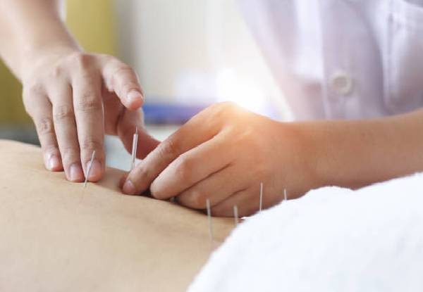 45-Minute Acupuncture & Facial Massage for One Person - Option for 30-Minute Facial Massage & to incl. a Skincare Product to Take Home