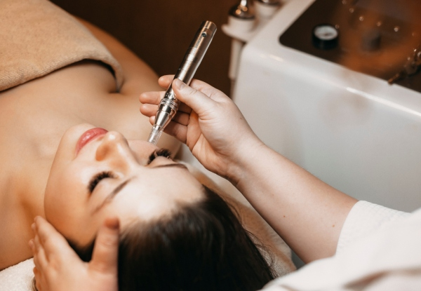 45-Minute Micro Needling Session for Face incl. Cleansing, Mask & Face Massage