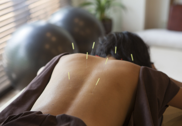 Pro Acupuncture Christchurch