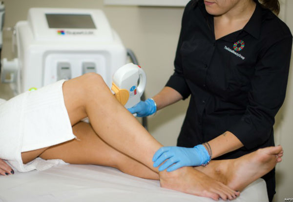 IPL Superfast Permanent Hair Removal 
- Options for Full Leg incl. Bikini, Feet & Toes or Back, Back of Neck or Chest & Front of Neck