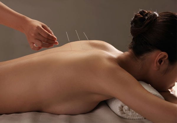 John Yuan Acupuncture & Good Health Centre Hamilton