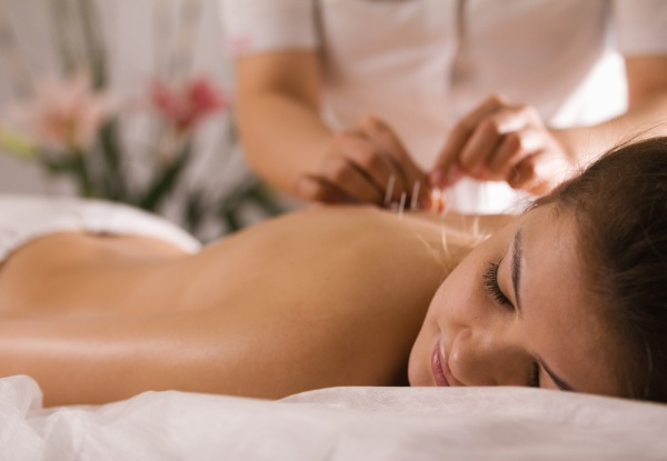 One-Hour Acupuncture with Six Different Styles Available - Options for Period, Insomnia, Stress Relief, Anxiety, Depression & Cold Hand or Feet Treatments