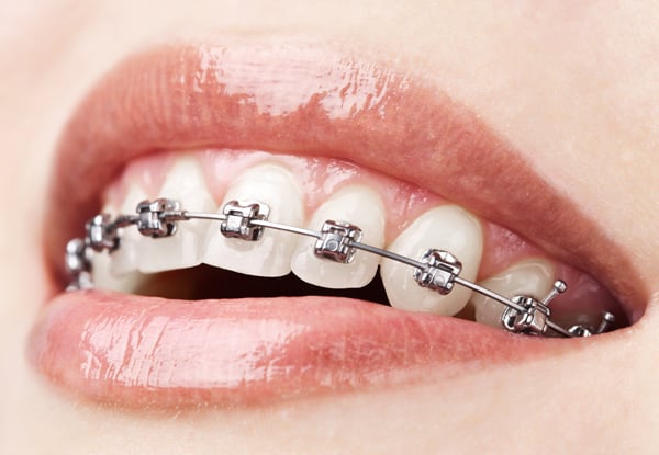 DentalcareWest