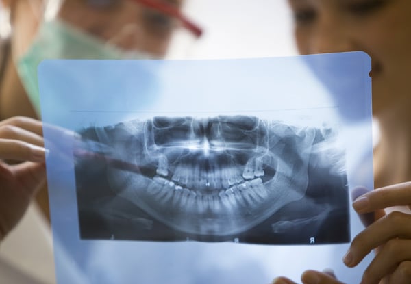 $99 for Dental Check Up & Hygienist Clean (value up to $217)