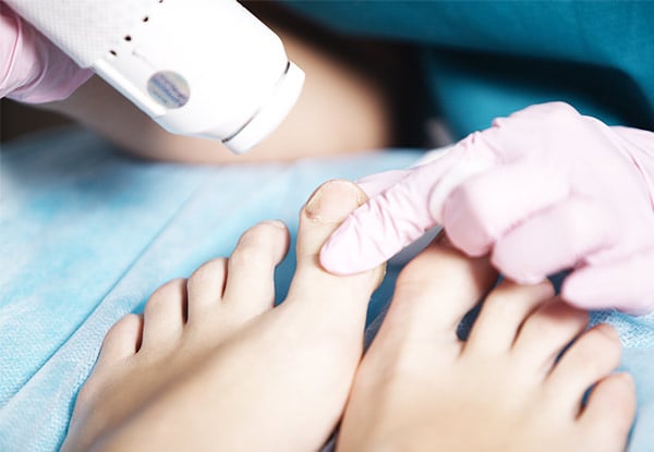$97 for a One-Foot Advanced Laser Treatment for Toenail Fungus or $188 for Both Feet (value up to $400)