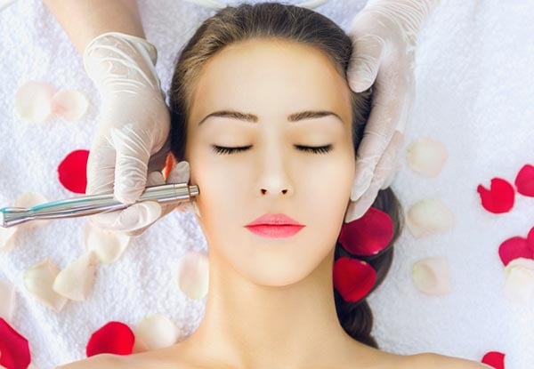 From $45 for a Glycolic C Microdermabrasion Facial - Options Available for Three or Six Facials (value up to $510)