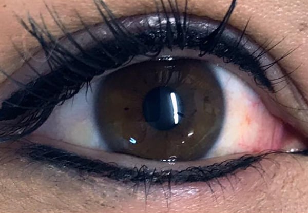 Enhanced Beauty Cosmetic Tattoo