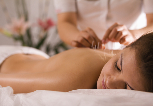 60-Minute Acupuncture Treatment for One Person - Option for ACC-Injury Treatment, Acupuncture & Cupping, Acupuncture & Massage