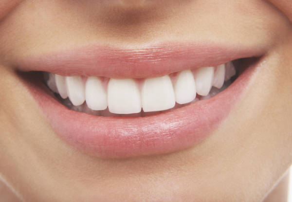 Dental Check-Up & Whitening Package incl. Examination, X-Rays, Scale, Polish & Teeth Whitening