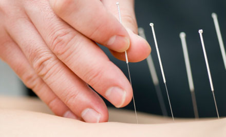Aroha Acupuncture