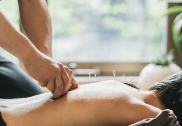 48-Minute Cupping Treatment for One Person - Options for Herb Moxibustion, Hotstone with Aroma Oil Acupressure or Acupuncture with Cupping