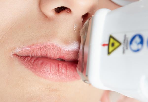 Five IPL Sessions - Options for Upper Lip, Underarms or Brazillian