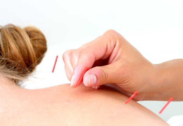 $35 for One-Hour Traditional Acupuncture or $70 for 1.5-Hour Cosmetic Acupuncture Session