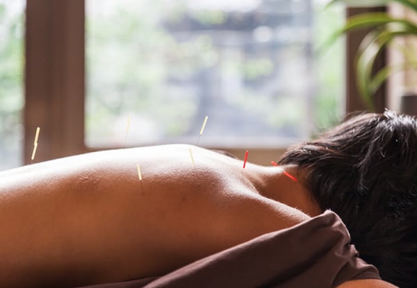 Rimutaka Acupuncture Clinic
