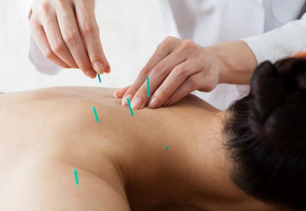 Top Town Acupuncture Clinic