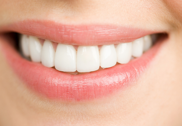 45-Minute Teeth Whitening Treatment for One Person incl. Consultation & Staining Treatment - Options for up to 90-Minutes & for Two People