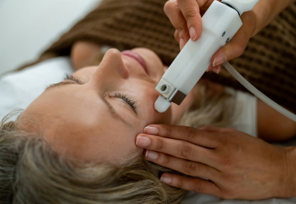 One Microdermabrasion Session - Option for Two or Three Sessions Available