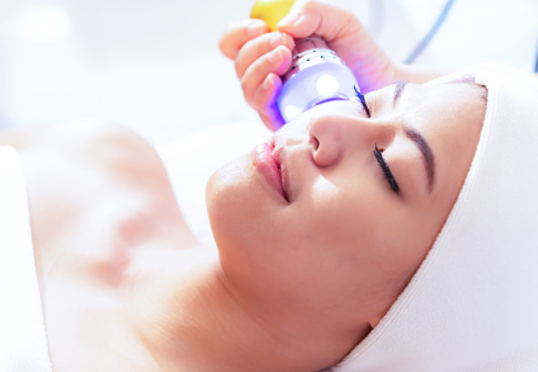 One Session of Full-Face Carbon Laser Peel Treatment for One Person - Option for Three Sessions