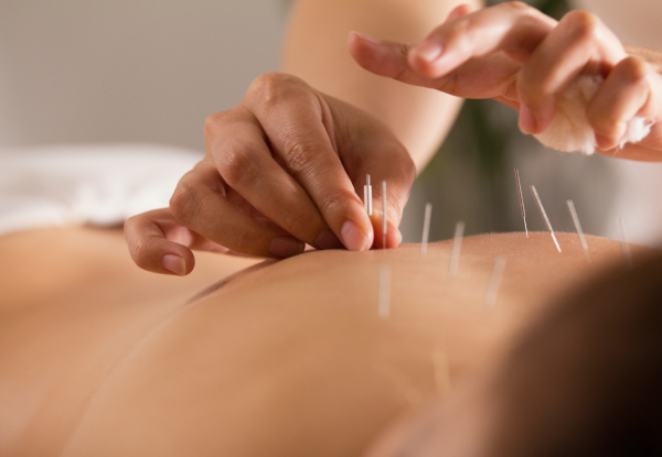 Amazing Acupuncture
