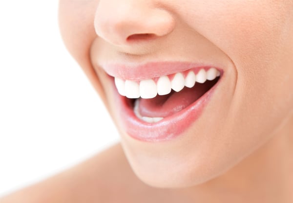 Lumino The Dentists – Ponsonby Dentist