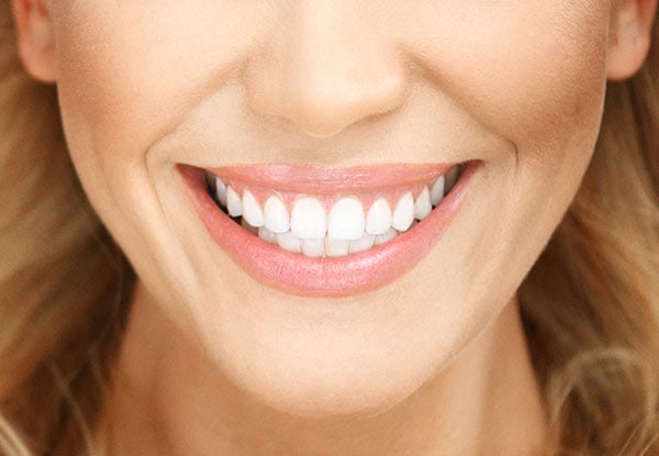 Two Cycles of Light to Meidum Staining Teeth Whitening Treatment for One Person - Options for Heavy Staining or Touch Up Whitening
