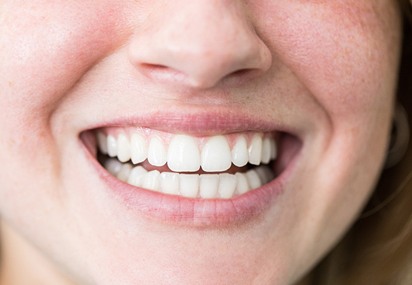 $200 Dental Treatment Voucher on Services of Your Choice