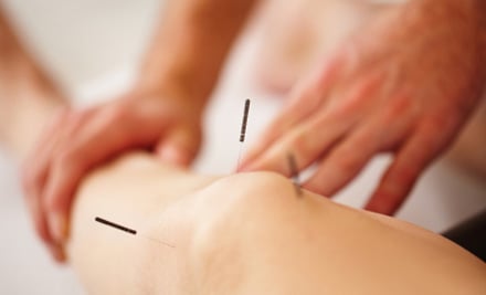 Anna Cherry Acupuncture