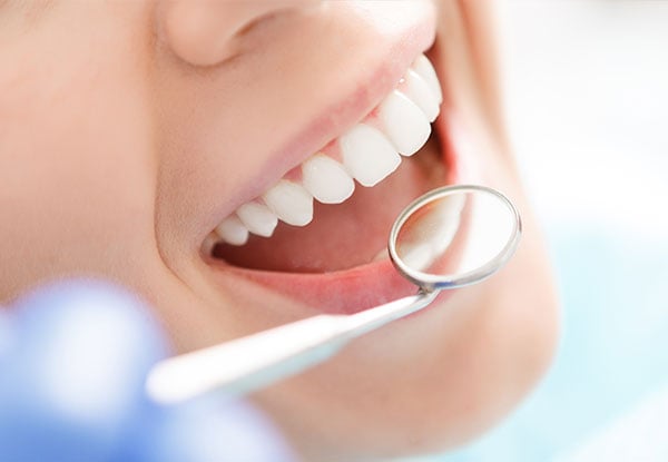 From $119 for Surgical Removal of One Tooth incl. Full Consultation, X-Rays, Oral Sedation & Post Surgery Care - Options Available for Wisdom Teeth (value up to $1,400)