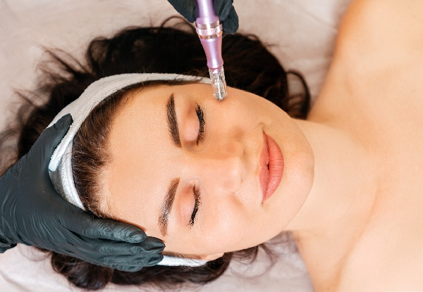 Micro-Needling Treatment for Problematic Skin