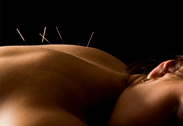 One-Hour Acupuncture or Therapeutic Massage with Options for One, Two or Three Sessions
