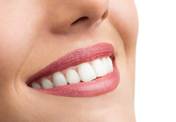Whitersmile