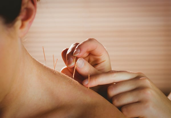 Tuina Chinese Massage & Acupuncture Consultation & Treatment Session at Central Health Clinic, Lambton Quay