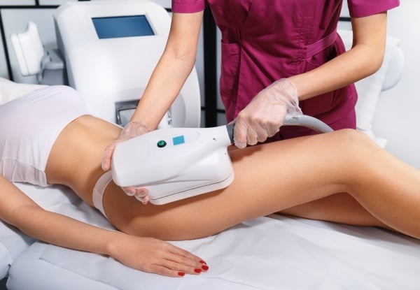 Fat Freezing Cool Sculpting Session on One Area - Option for Two Sessions on Two Areas — photo 3